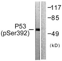 p53 (phospho Ser392) Polyclonal Antibody