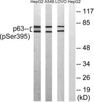 p63 (phospho Ser395) Polyclonal Antibody