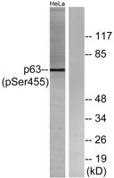 p63 (phospho Ser455) Polyclonal Antibody