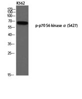 p70 S6 kinase α (phospho Ser427) Polyclonal Antibody