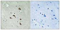 p70 S6 kinase α (phospho Ser427) Polyclonal Antibody