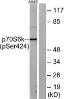 p70 S6 kinase α (phospho Ser447) Polyclonal Antibody