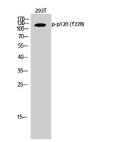 p120 (phospho Tyr228) Polyclonal Antibody