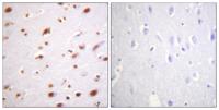 p120 (phospho Tyr228) Polyclonal Antibody