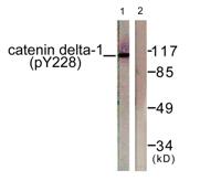 p120 (phospho Tyr228) Polyclonal Antibody