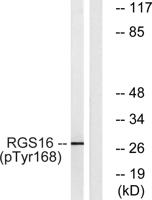 RGS16 (phospho Tyr168) Polyclonal Antibody