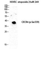 Fusin (phospho Ser339) Polyclonal Antibody