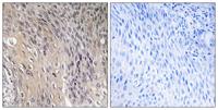 Rho GDIα (phospho Ser174) Polyclonal Antibody