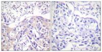 Adducin α (phospho Thr445) Polyclonal Antibody