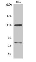 Adducin α/β (phospho Ser726/713) Polyclonal Antibody