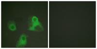 Adducin α/β (phospho Ser726/713) Polyclonal Antibody