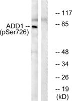 Adducin α/β (phospho Ser726/713) Polyclonal Antibody