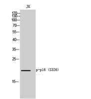 p16-INK4a (Phospho Ser152) rabbit pAb