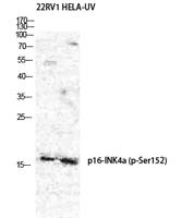 p16-INK4a (Phospho Ser152) rabbit pAb