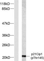 p21 (phospho Thr145) Polyclonal Antibody