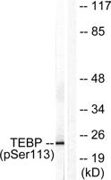 p23 (phospho Ser113) Polyclonal Antibody