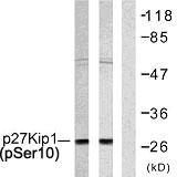 p27 (phospho Ser10) Polyclonal Antibody