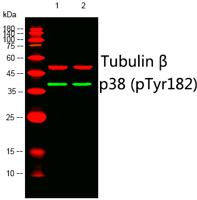 p38 (phospho Tyr182) Polyclonal Antibody