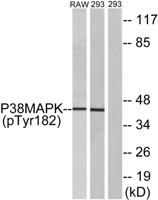 p38 (phospho Tyr182) Polyclonal Antibody