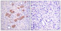 p40-phox (phospho Thr154) Polyclonal Antibody