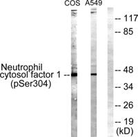 p47-phox (phospho Ser304) Polyclonal Antibody