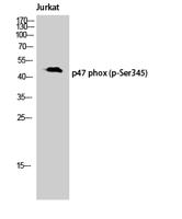 p47-phox (phospho Ser345) Polyclonal Antibody