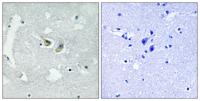 p47-phox (phospho Ser345) Polyclonal Antibody