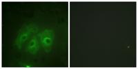 p47-phox (phospho Ser359) Polyclonal Antibody