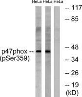 p47-phox (phospho Ser359) Polyclonal Antibody