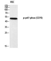 p47-phox (phospho Ser370) Polyclonal Antibody