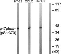 p47-phox (phospho Ser370) Polyclonal Antibody