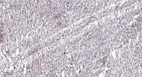 PKD2 (phospho Ser812) Polyclonal Antibody