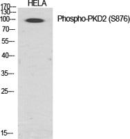 PKD2 (phospho Ser876) Polyclonal Antibody