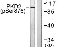 PKD2 (phospho Ser876) Polyclonal Antibody