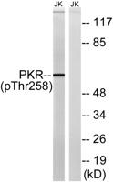 PKR (phospho Thr258) Polyclonal Antibody