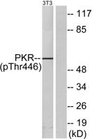 PKR (phospho Thr446) Polyclonal Antibody