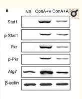 PKR (phospho Thr446) Polyclonal Antibody