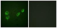 PLB (phospho Ser16/T17) Polyclonal Antibody