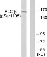 PLC β3 (phospho Ser1105) Polyclonal Antibody