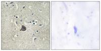 PLC β3 (phospho Ser537) Polyclonal Antibody