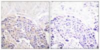 PLC γ1 (phospho Tyr771) Polyclonal Antibody