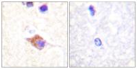 PLC γ2 (phospho Tyr1217) Polyclonal Antibody