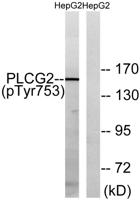 PLC γ2 (phospho Tyr753) Polyclonal Antibody