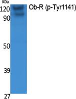 Ob-R (phospho Tyr1141) Polyclonal Antibody