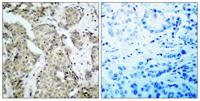 MEK-3 (phospho Ser218) Polyclonal Antibody