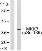 MEK-3 (phospho Ser218) Polyclonal Antibody