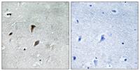 MEK-3 (phospho Thr222) Polyclonal Antibody