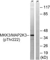 MEK-3 (phospho Thr222) Polyclonal Antibody