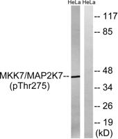 MEK-7 (phospho Thr275) Polyclonal Antibody