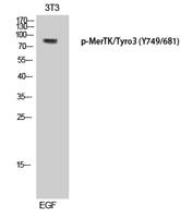 MerTK/Tyro3 (phospho Tyr749/681) Polyclonal Antibody